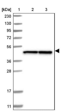 TUFM Antibody, Novus Biologicals:Antibodies:Primary Antibodies