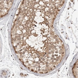 TUG Antibody, Novus Biologicals 0.1mL; Unlabeled:Antibodies, Polyclonal