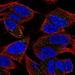 TVP23A Antibody, Novus Biologicals 0.1mL; Unlabeled:Antibodies, Polyclonal