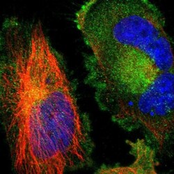 TWEAK R/TNFRSF12 Antibody, Novus Biologicals:Antibodies:Primary Antibodies