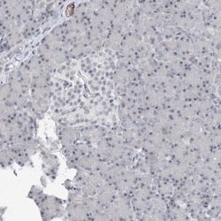 TXLNB Antibody, Novus Biologicals 0.1mL; Unlabeled:Antibodies, Polyclonal