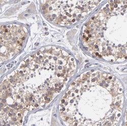 TXNDC Antibody, Novus Biologicals 25 &mu;L; Unlabeled:Antibodies, Polyclonal