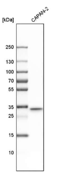 TXNDC Antibody, Novus Biologicals 25 &mu;L; Unlabeled:Antibodies, Polyclonal
