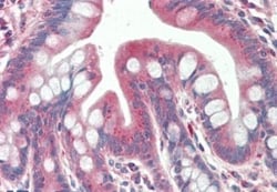 TXNDC11 Antibody, Novus Biologicals 0.1mg; Unlabeled:Antibodies, Polyclonal