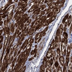 TXNDC11 Antibody, Novus Biologicals 25 &mu;L; Unlabeled:Antibodies, Polyclonal