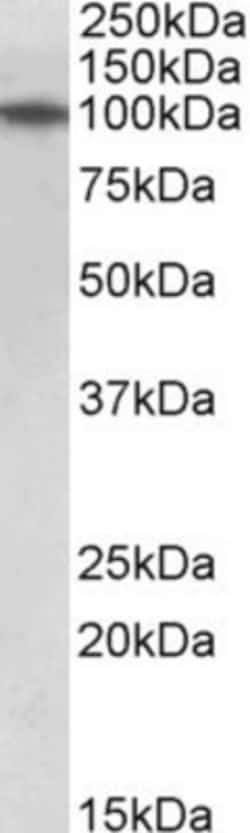 TXNDC11 Antibody, Novus Biologicals 0.1mg; Unlabeled:Antibodies, Polyclonal