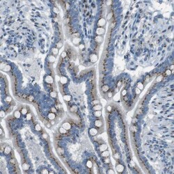 TXNDC15 Antibody, Novus Biologicals 25 &mu;L | Buy Online | Novus Biologicals | Fisher Scientific