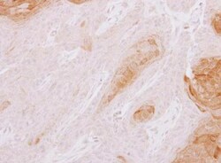 TXNDC3 Antibody, Novus Biologicals 0.1mg; Unlabeled:Antibodies, Polyclonal