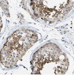 TXNDC3 Antibody, Novus Biologicals 0.1mL; Unlabeled:Antibodies, Polyclonal