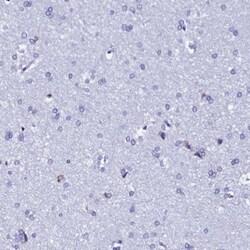 TXNDC5 Antibody, Novus Biologicals 25 &mu;L, Unlabeled:Antibodies, Polyclonal