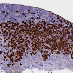 TXNDC5 Antibody, Novus Biologicals 25 &mu;L, Unlabeled:Antibodies, Polyclonal