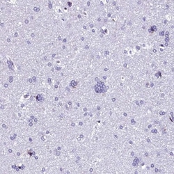 TXNDC5 Antibody, Novus Biologicals 25ul | Buy Online | Novus Biologicals | Fisher Scientific