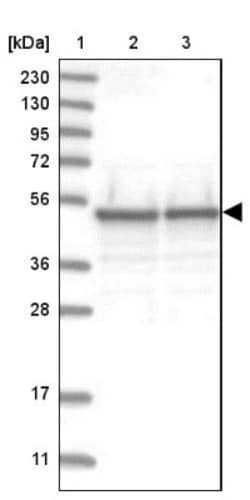 TXNDC5 Antibody, Novus Biologicals 25ul | Buy Online | Novus Biologicals | Fisher Scientific