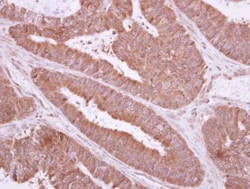 TXNDC6 Antibody, Novus Biologicals 0.1mL; Unlabeled:Antibodies, Polyclonal
