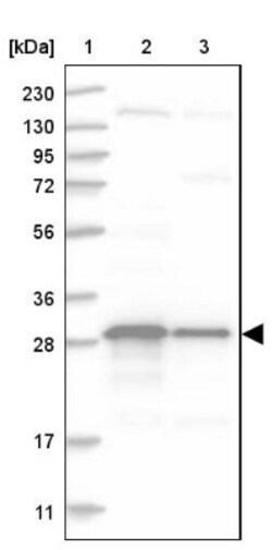 TXNDC9 Antibody, Novus Biologicals 25 &mu;L; Unlabeled:Antibodies, Polyclonal