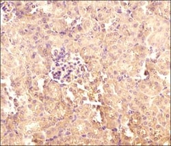 TXNIP Antibody (JY2) - Azide and BSA Free, Novus Biologicals 0.1 mg, Unconjugated:Antibodies,