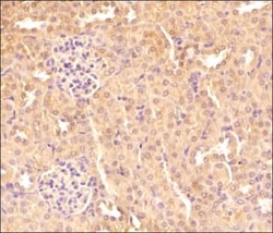 TXNIP Antibody (JY2) - Azide and BSA Free, Novus Biologicals 0.1 mg, Unconjugated:Antibodies,