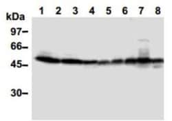 TXNIP Antibody (JY2) - Azide and BSA Free, Novus Biologicals 0.1 mg, Unconjugated:Antibodies,