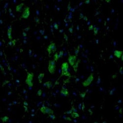 TXNL1 Antibody, Novus Biologicals 0.1mL; Unlabeled:Antibodies, Polyclonal