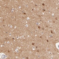 TXNL1 Antibody, Novus Biologicals 0.1mL; Unlabeled:Antibodies, Polyclonal