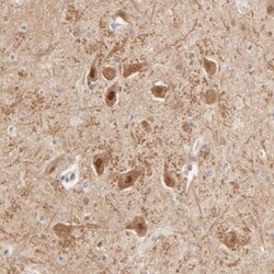 TXNL1 Antibody, Novus Biologicals 0.1mL; Unlabeled:Antibodies, Polyclonal