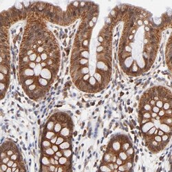 TXNL1 Antibody, Novus Biologicals 0.1mL; Unlabeled:Antibodies, Polyclonal