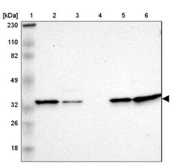 TXNL1 Antibody, Novus Biologicals 0.1mL; Unlabeled:Antibodies, Polyclonal