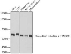 TXNRD2 Rabbit anti-Human, Mouse, Rat, Clone: 4O1K0, Novus Biologicals 100 &mu;g | Buy Online | Bio-Techne | Fisher Scientific