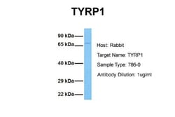 TYRP1 Antibody, Novus Biologicals 0.05mg; Unlabeled:Antibodies, Polyclonal
