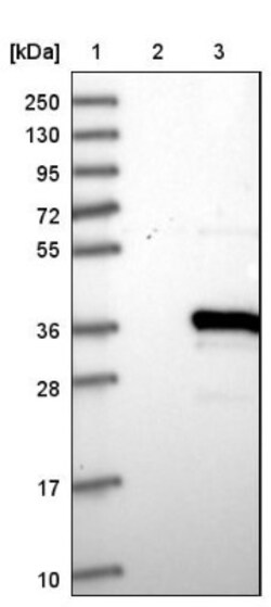 TYW3 Antibody, Novus Biologicals 0.1 mL | Buy Online | Novus Biologicals | Fisher Scientific