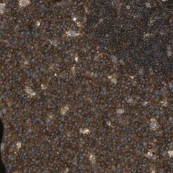 Talin1 Antibody, Novus Biologicals:Antibodies:Primary Antibodies