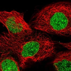 Tankyrase 1 Antibody, Novus Biologicals 25 &mu;L; Unlabeled:Antibodies,