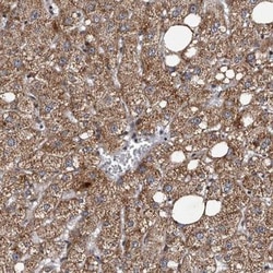 Tankyrase 1 Antibody, Novus Biologicals 25 &mu;L; Unlabeled:Antibodies,