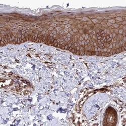 Tankyrase binding protein 1 Antibody, Novus Biologicals 0.1mL; Unlabeled:Antibodies,
