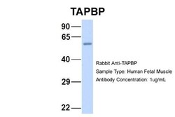 Tapasin Antibody, Novus Biologicals:Antibodies:Primary Antibodies