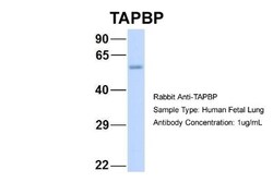 Tapasin Antibody, Novus Biologicals:Antibodies:Primary Antibodies