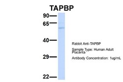 Tapasin Antibody, Novus Biologicals:Antibodies:Primary Antibodies
