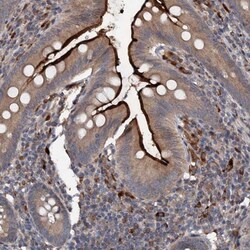 Tapasin Related Protein Antibody, Novus Biologicals 0.1mL; Unlabeled:Antibodies,