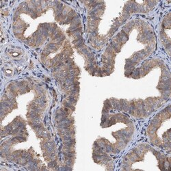 Tapasin Related Protein Antibody, Novus Biologicals 0.1mL; Unlabeled:Antibodies,