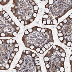 Tapasin Related Protein Antibody, Novus Biologicals 0.1mL; Unlabeled:Antibodies,