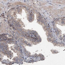 Tapasin Related Protein Antibody, Novus Biologicals 0.1mL; Unlabeled:Antibodies,