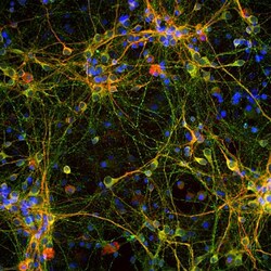 Tau Antibody, Novus Biologicals:Antibodies:Primary Antibodies
