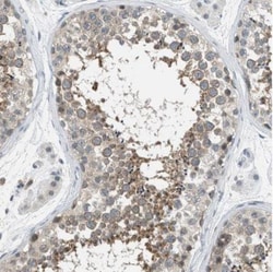 Tau tubulin kinase 2 Antibody, Novus Biologicals:Antibodies:Primary Antibodies
