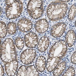 TauT/SLC6A6 Antibody, Novus Biologicals 0.1mL; Unlabeled:Antibodies, Polyclonal