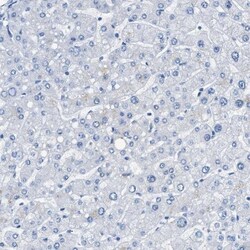 TauT/SLC6A6 Antibody, Novus Biologicals 0.1mL; Unlabeled:Antibodies, Polyclonal