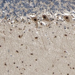Tbp7 Antibody, Novus Biologicals 25 &mu;L; Unlabeled:Antibodies, Polyclonal