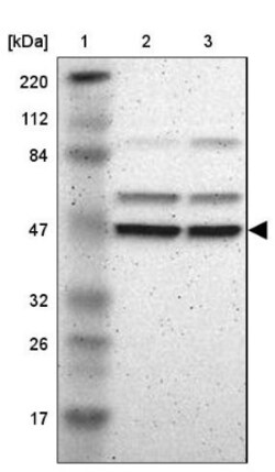 Tbp7 Antibody, Novus Biologicals 25 &mu;L; Unlabeled:Antibodies, Polyclonal