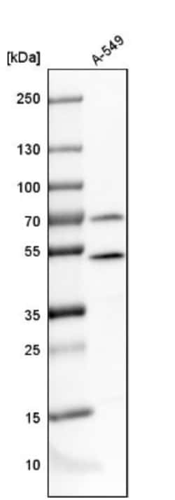 Tbp7 Antibody, Novus Biologicals 0.1mL; Unlabeled:Antibodies, Polyclonal