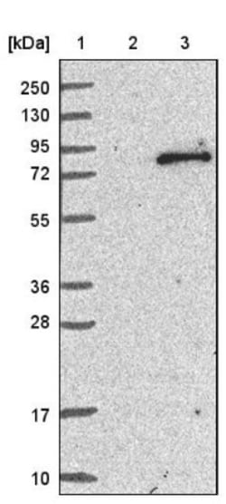 Tec Antibody, Novus Biologicals:Antibodies:Primary Antibodies