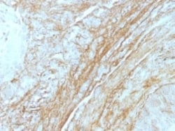 Tenascin C Antibody (T2H5), Novus Biologicals 0.2mg; Unlabeled:Antibodies,